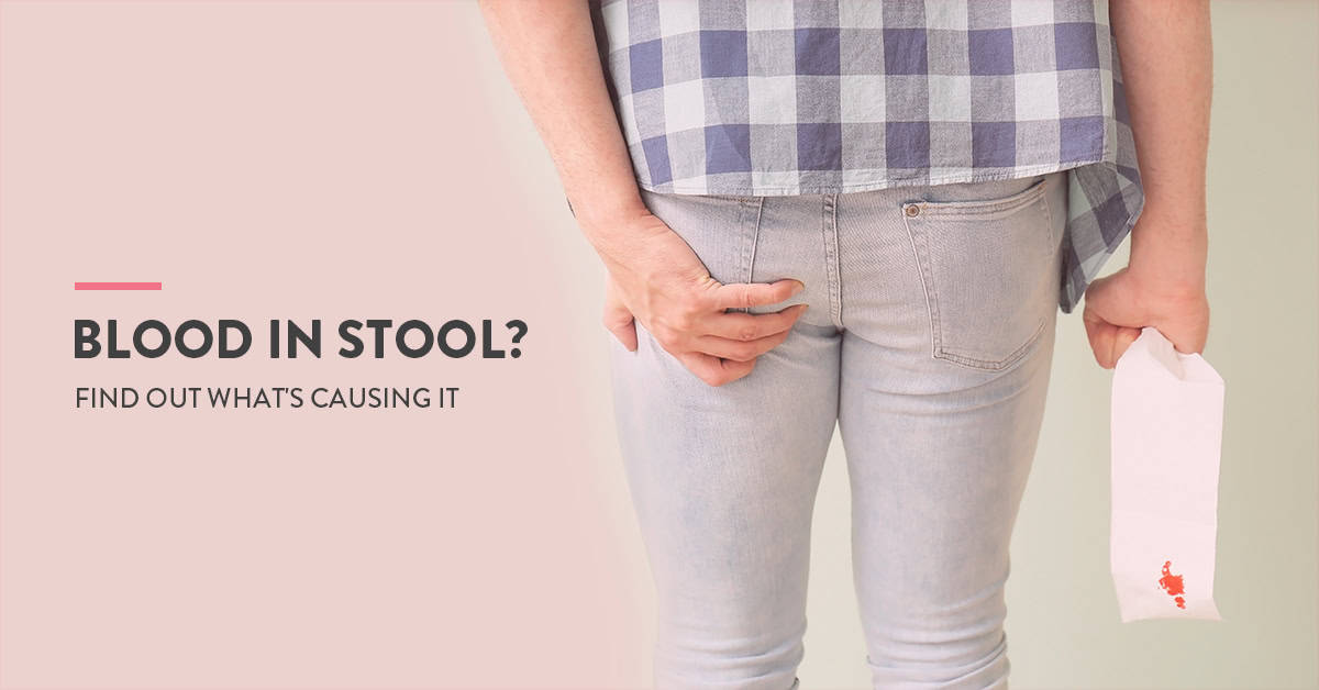 Blood in stool: Common causes & treatment