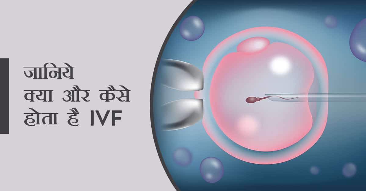 जानिए क्या होता है IVF (IVF kya hai) और कैसे की जाती है IVF प्रक्रिया 