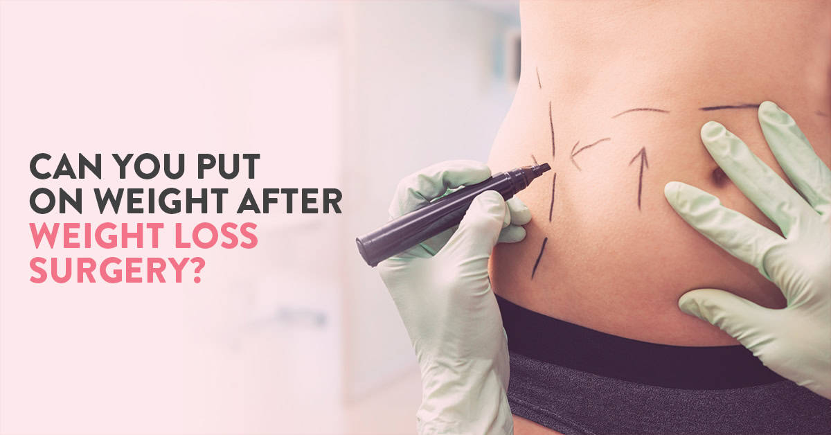Bariatric surgery – The ultimate weight loss solution?