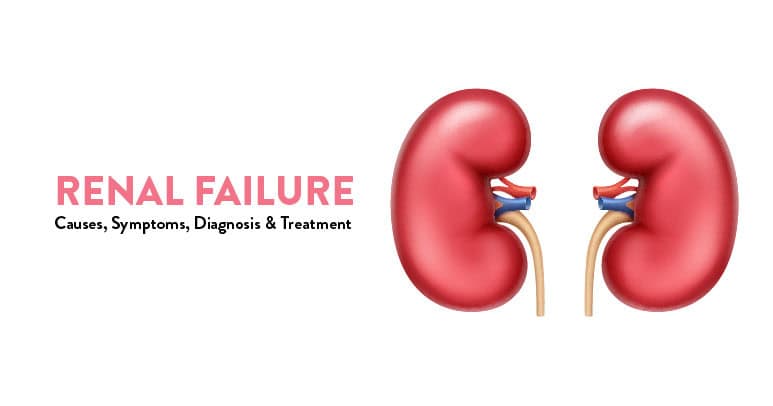 Renal Failure (Kidney Failure): Causes, Symptoms, Diagnosis, and Treatment