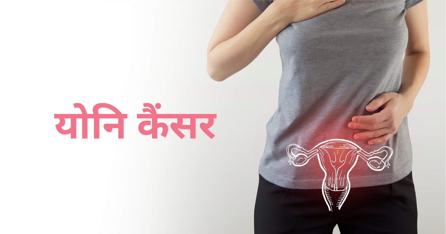 योनि कैंसर क्या है: कारण, लक्षण और उपचार (Vaginal Cancer in Hindi)