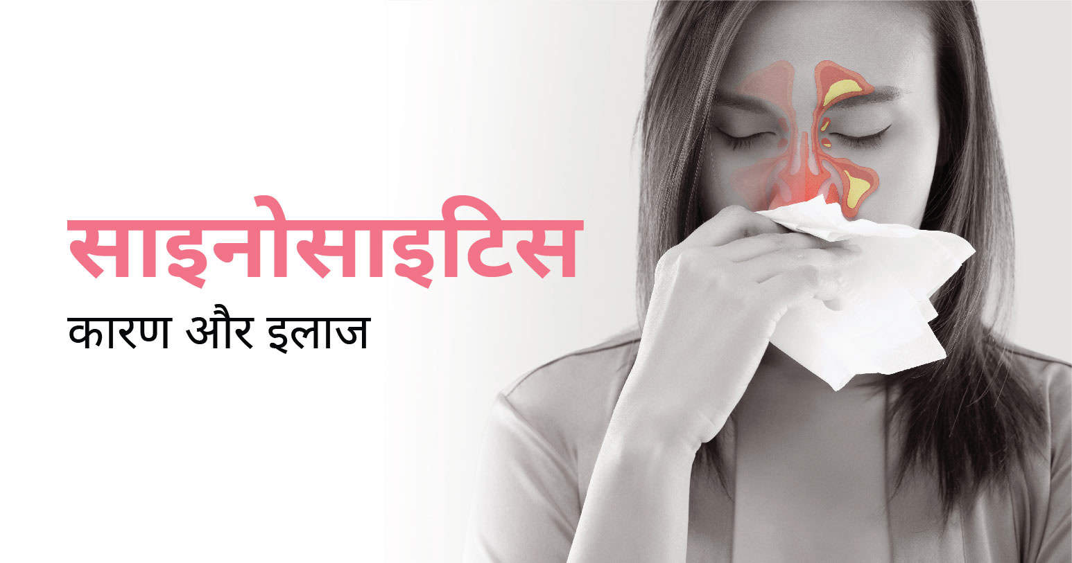 साइनोसाइटिस का कारण और इलाज | Sinusitis Causes & Treatment in Hindi