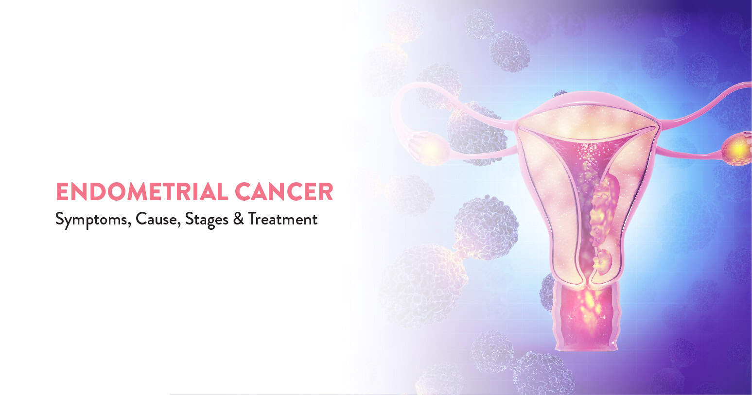 Endometrial Cancer: Symptoms, Causes & Treatments