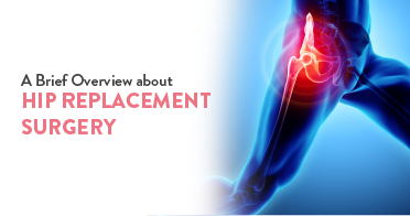A Brief Overview about Hip Replacement Surgery