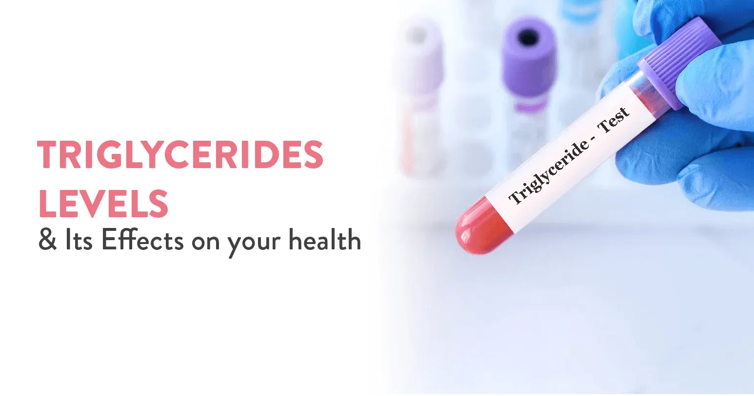 Triglycerides Levels and Its Effects on your health