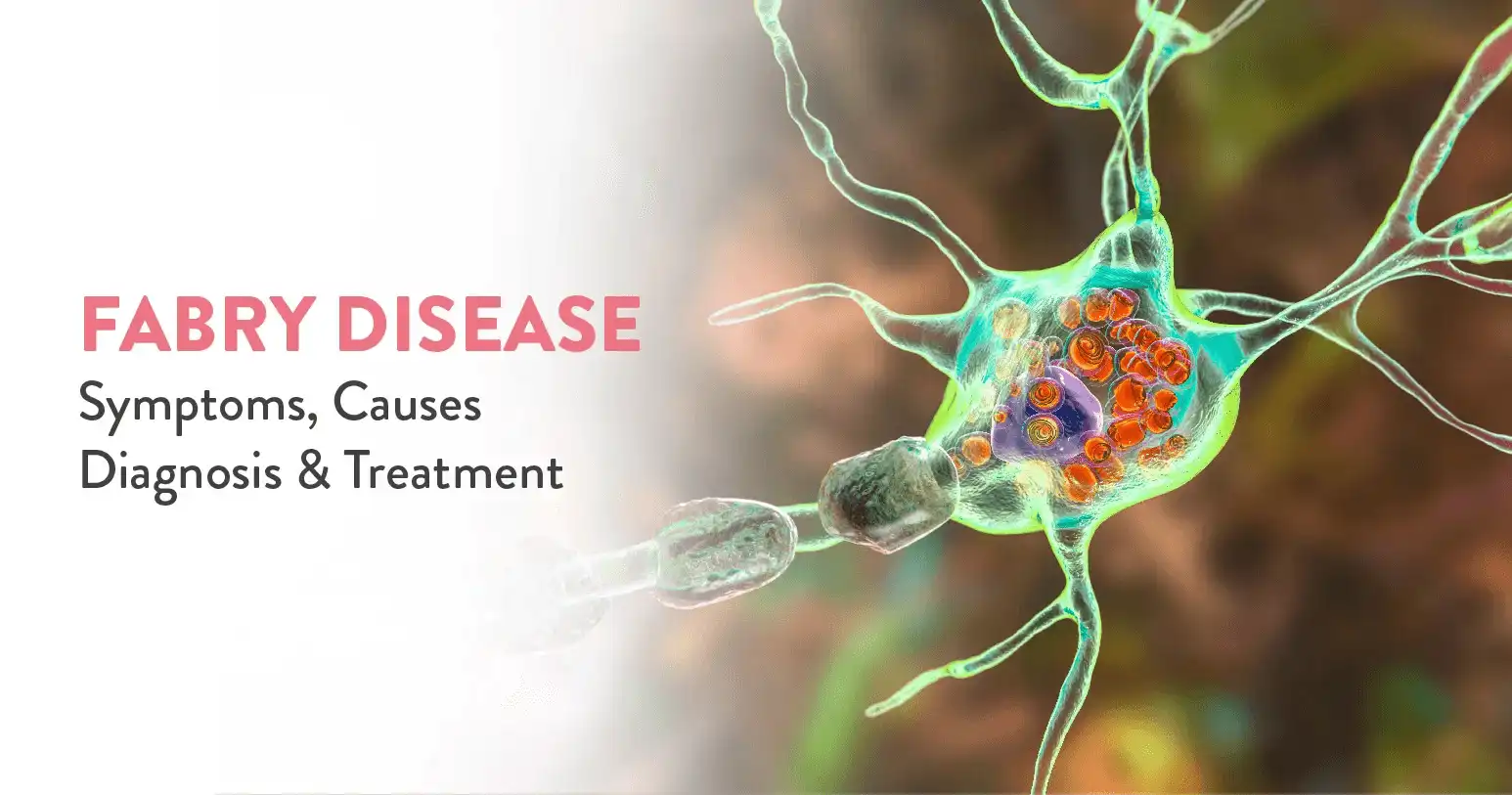 Fabry Disease: Symptoms, Causes, Diagnosis, and Treatment