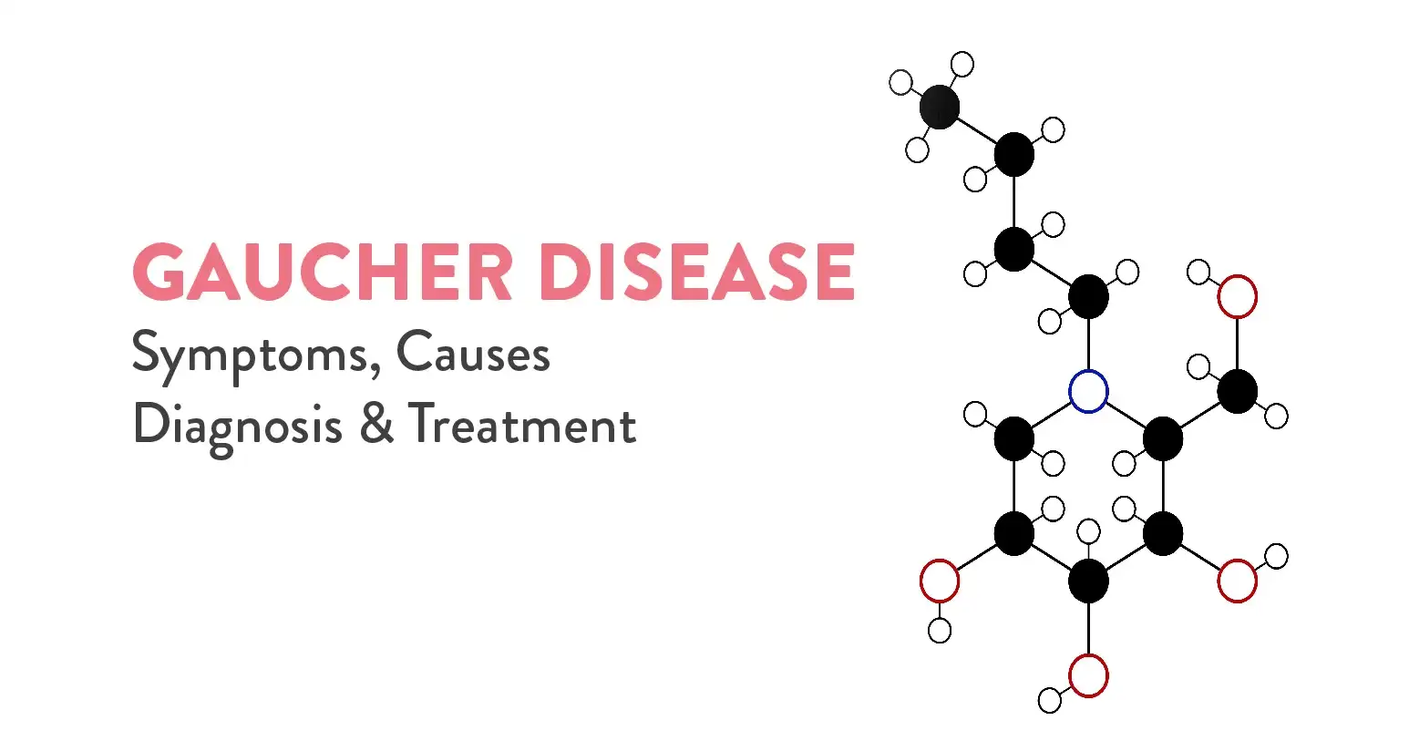 Gaucher Disease: Symptoms, Causes, Diagnosis, and Treatment