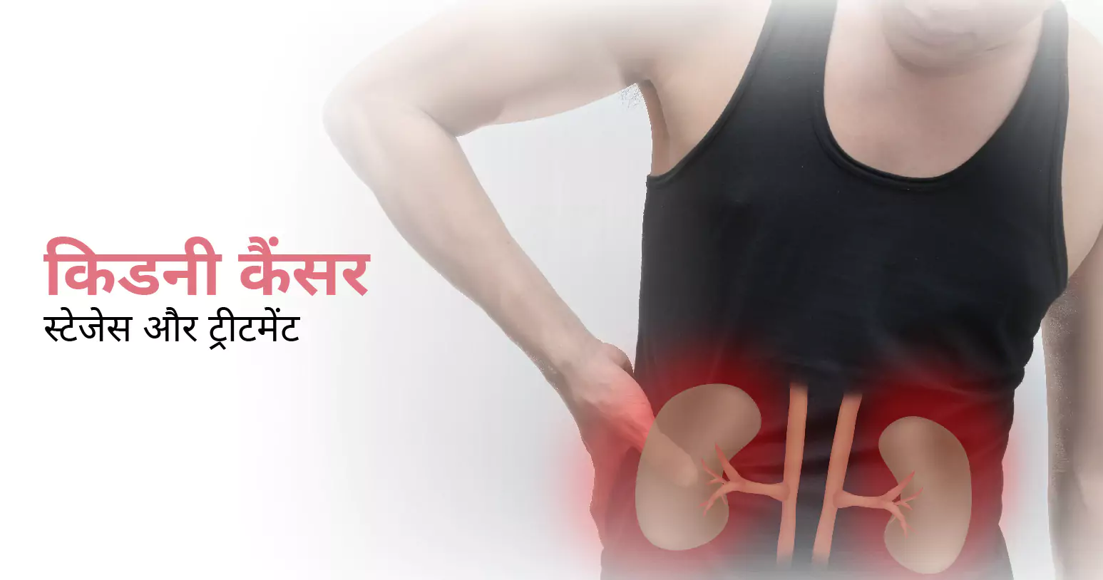 Caliectasis: Causes, Symptoms, and Treatment - CK Birla Hospital