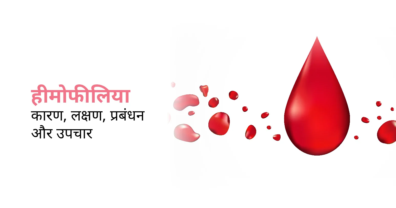 हीमोफीलिया क्या है:(Hemophilia)कारण, लक्षण, उपचार और बचाव