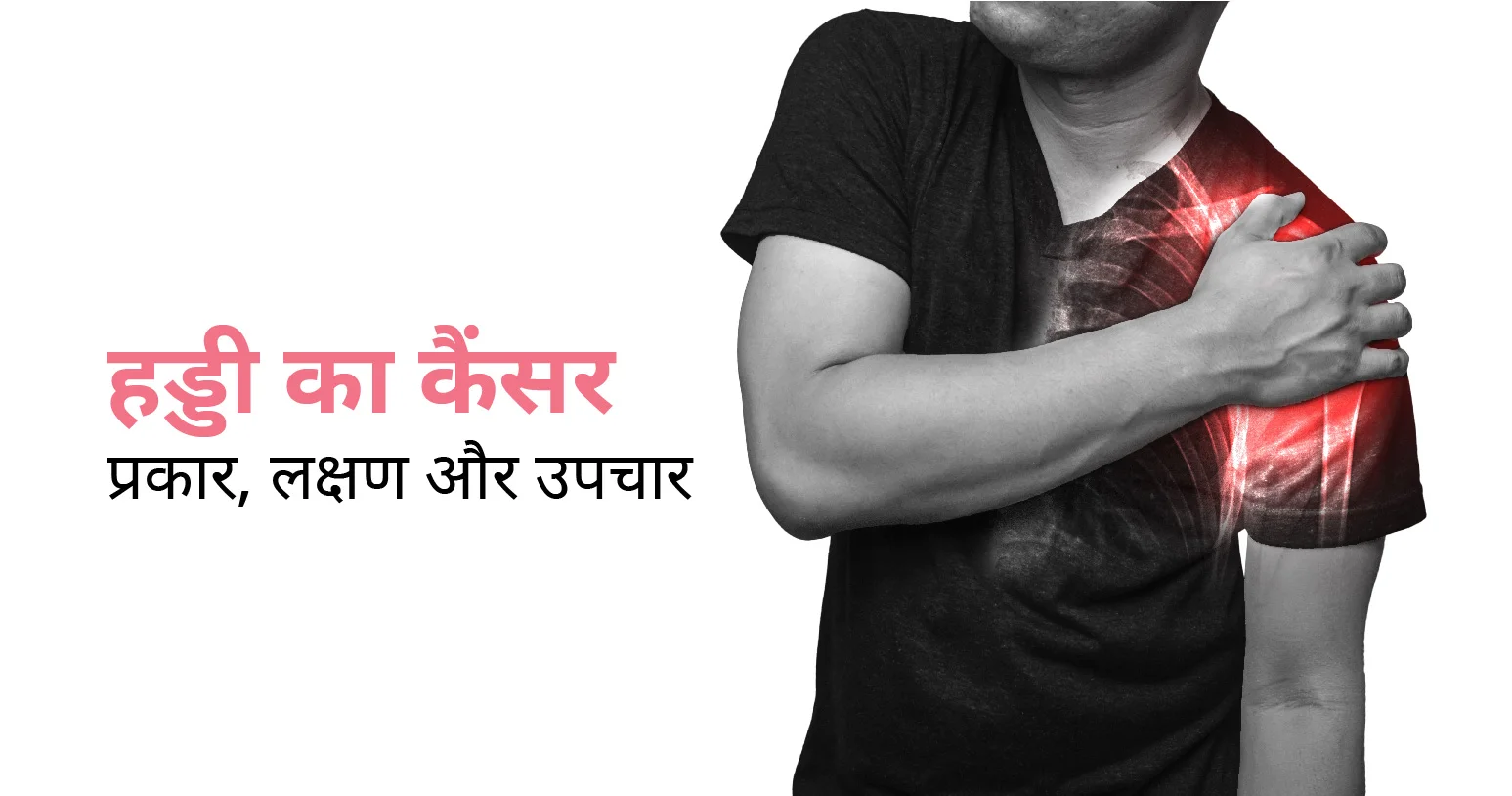 हड्डी का कैंसर: प्रकार, कारण, लक्षण और उपचार