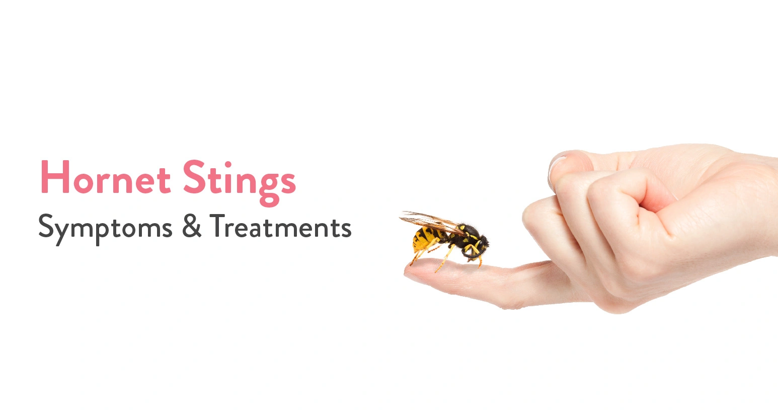 Hornet Stings: Symptoms & Treatments