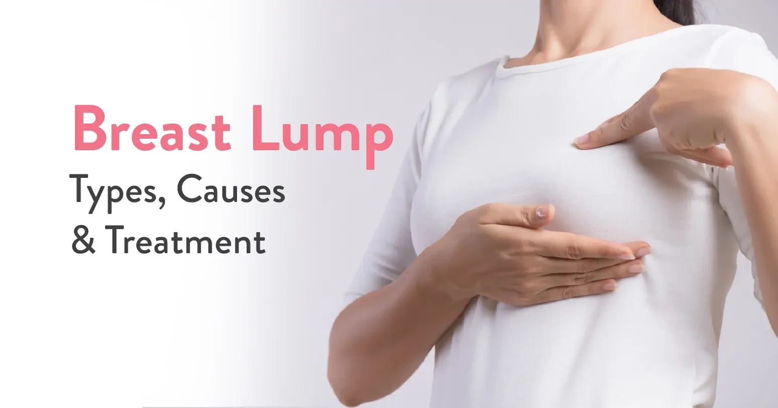 Breast Lump- Causes, Symptoms, Treatment & How to Identify it