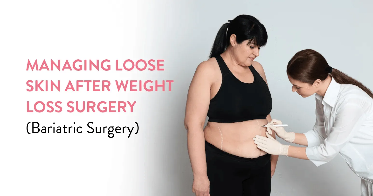 Managing Loose Skin After Weight Loss Surgery: Options & Considerations