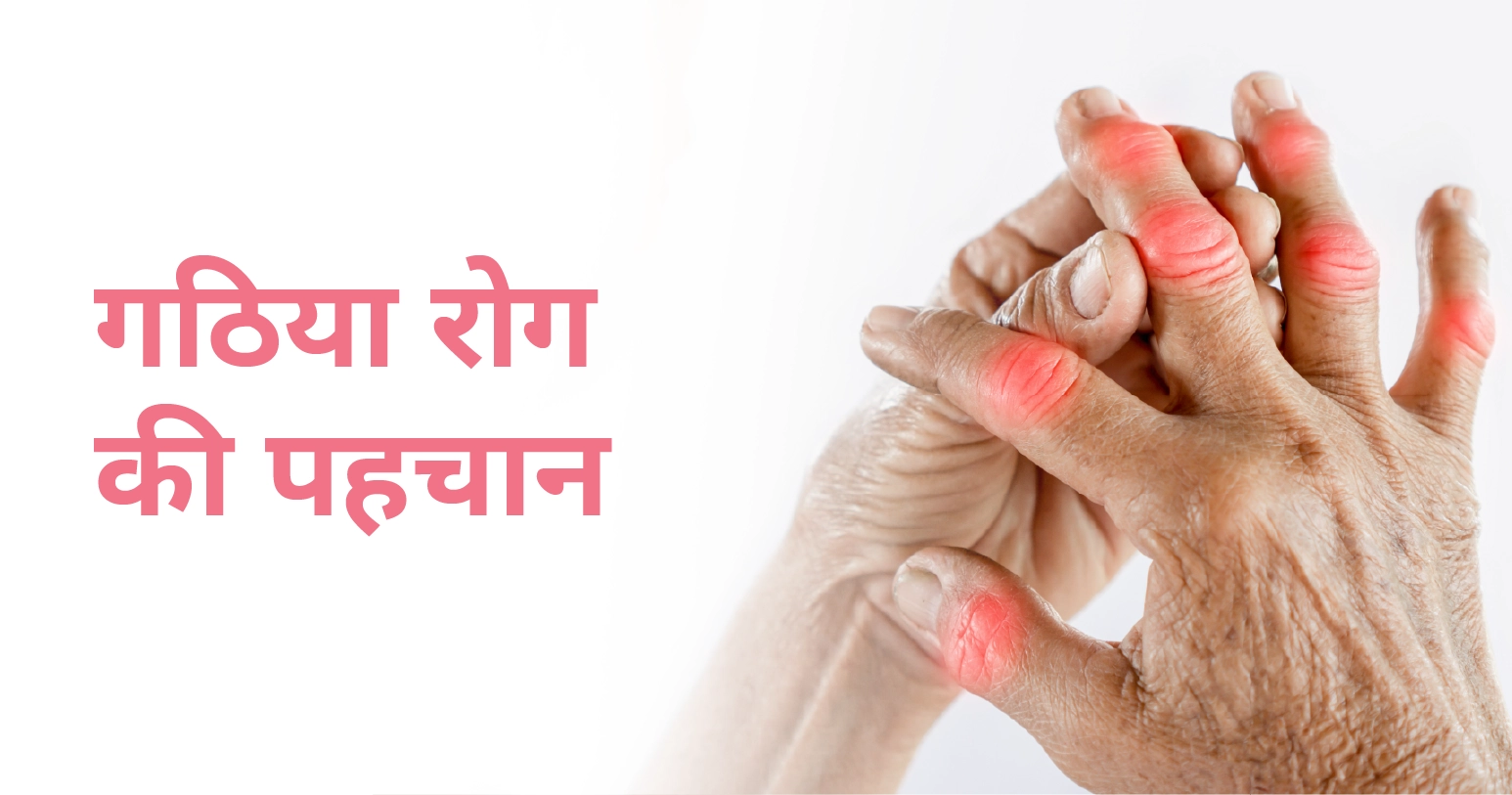 गठिया: कारण, लक्षण और उपचार