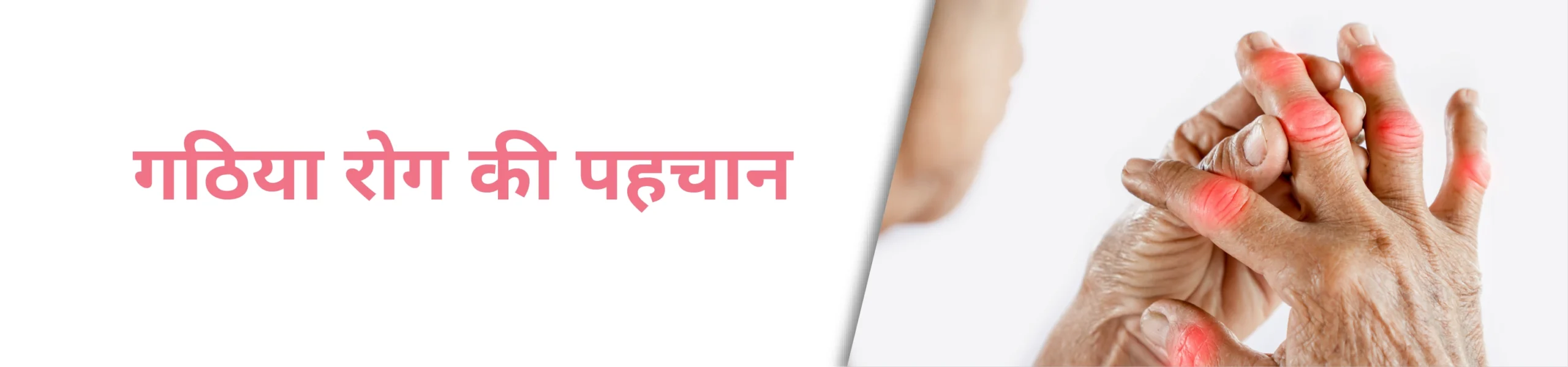 गठिया: कारण, लक्षण और उपचार