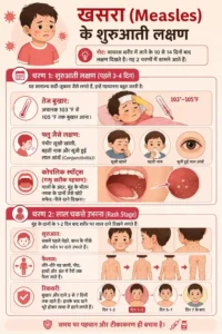 बच्चों में खसरा क्यों होता है? जानिए कारण और बचाव के तरीके