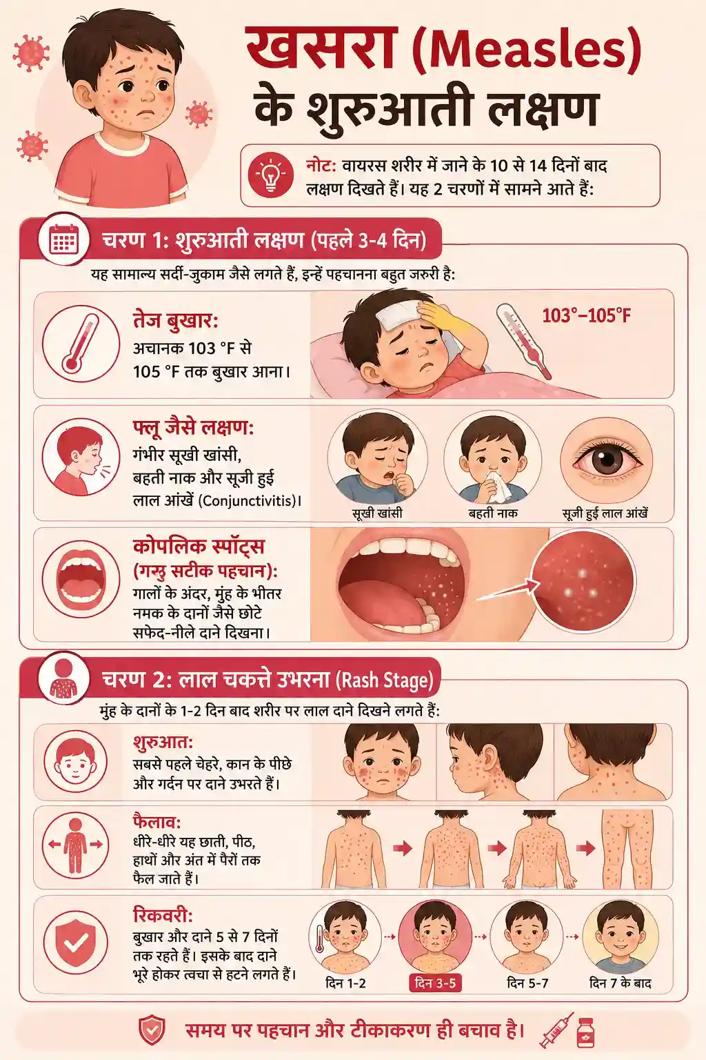 बच्चों में खसरा क्यों होता है? जानिए कारण और बचाव के तरीके