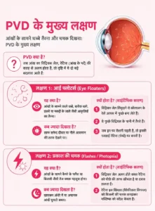 अचानक धुंधला दिखना या आंखों के सामने धब्बे तैरना? पोस्टीरियर विट्रियस डिटैचमेंट के संकेत जानें