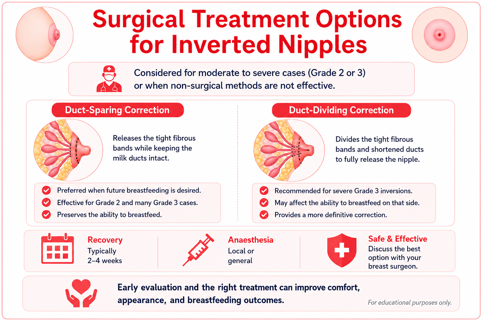 Surgical Treatment options for Inverted Nipples