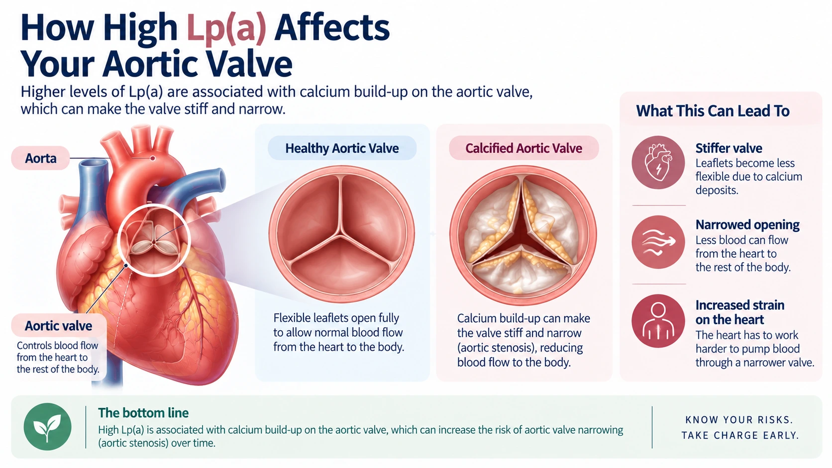 How high LP(a) affects your aortic valve