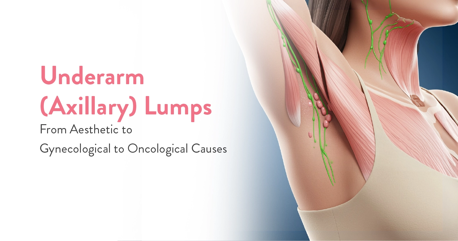 Underarm (Axillary) Lump: Causes, Diagnosis & Treatment