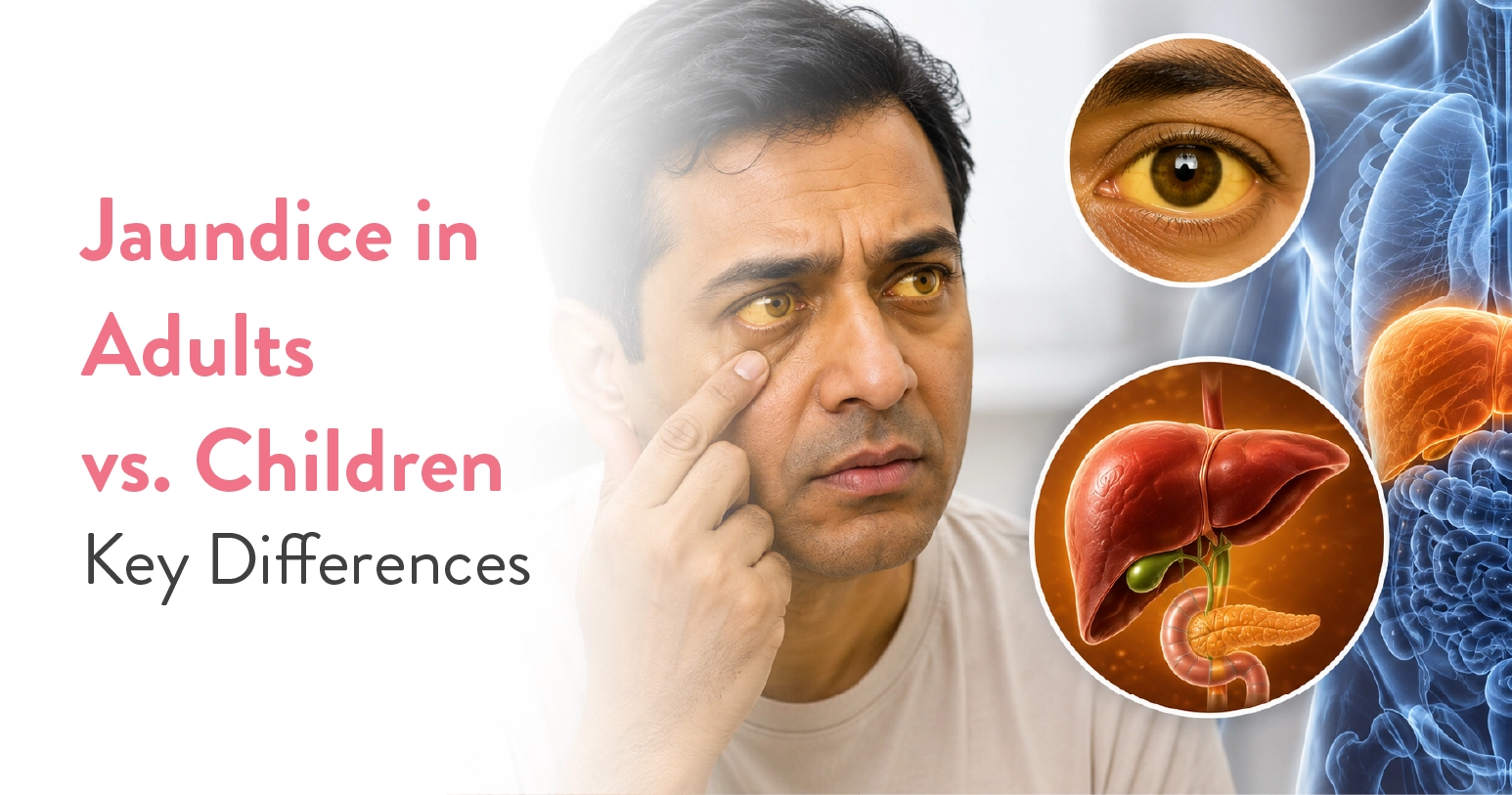 Jaundice in Adults vs Children: Causes, Symptoms & Treatment