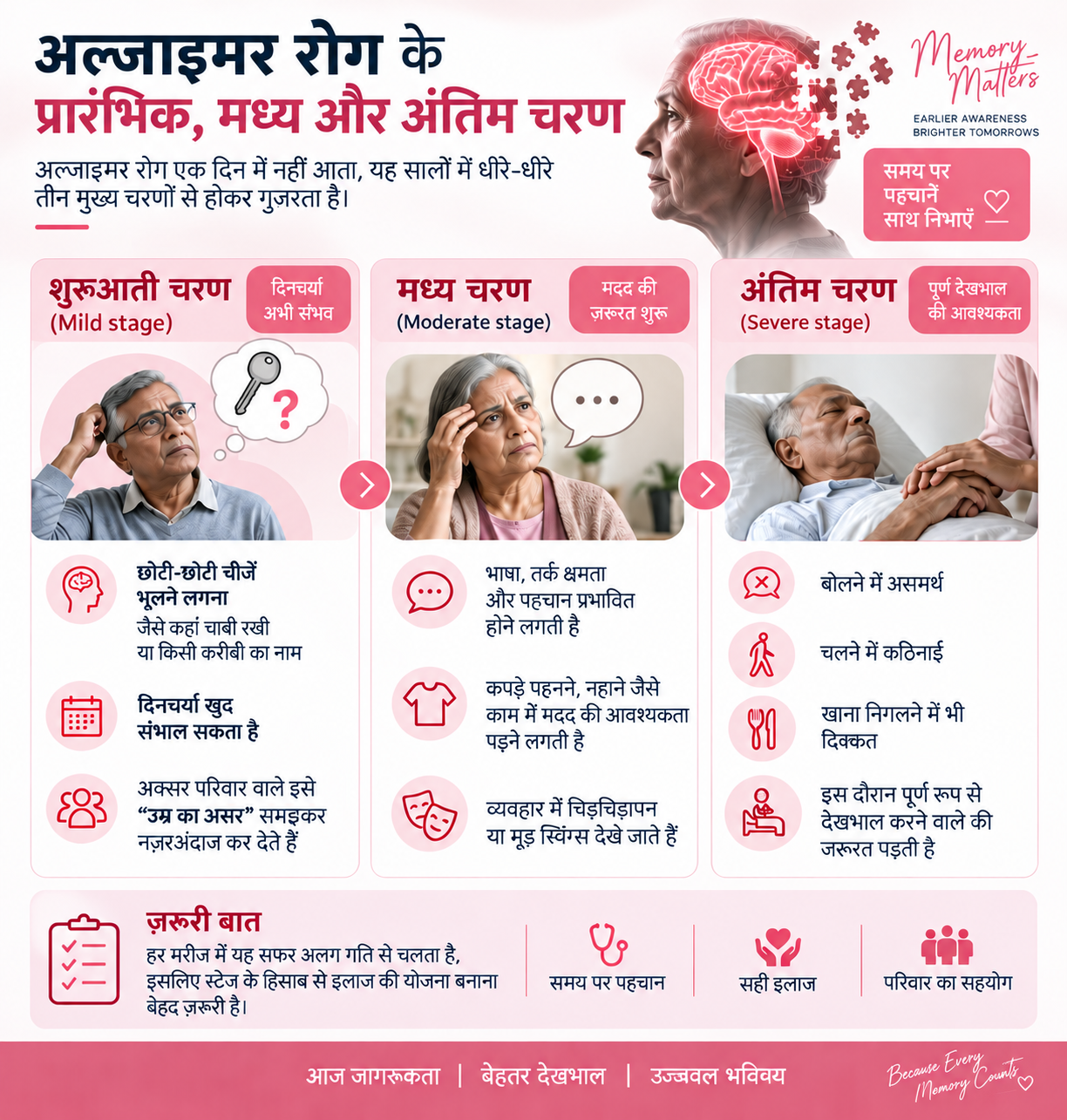 अल्जाइमर रोग के प्रारंभिक, मध्य और अंतिम चरण