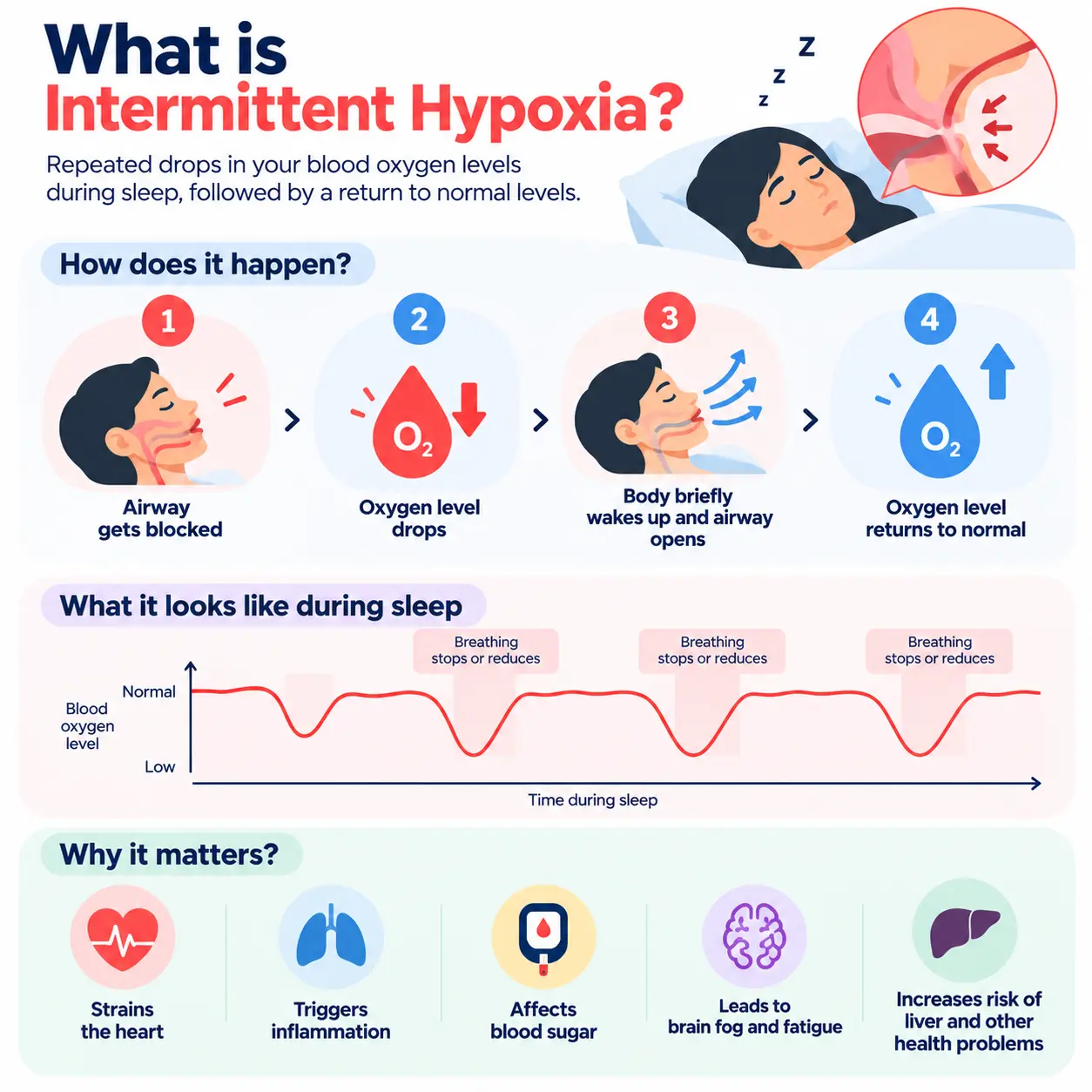 intermittent hypoxia
